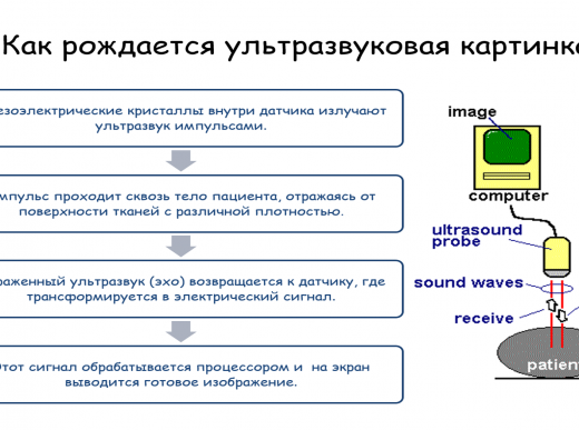 Диагностический ультразвук в специальности, кто владеет?